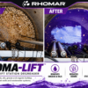 RHOMA-LIFT Before and After