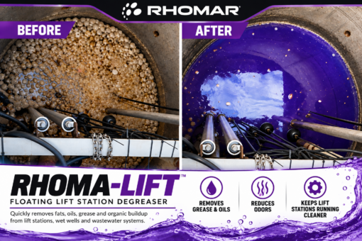 RHOMA-LIFT Before and After